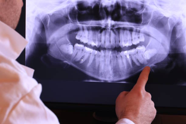 Best Orthodontic Emergency Dentist in Cole Camp, MO